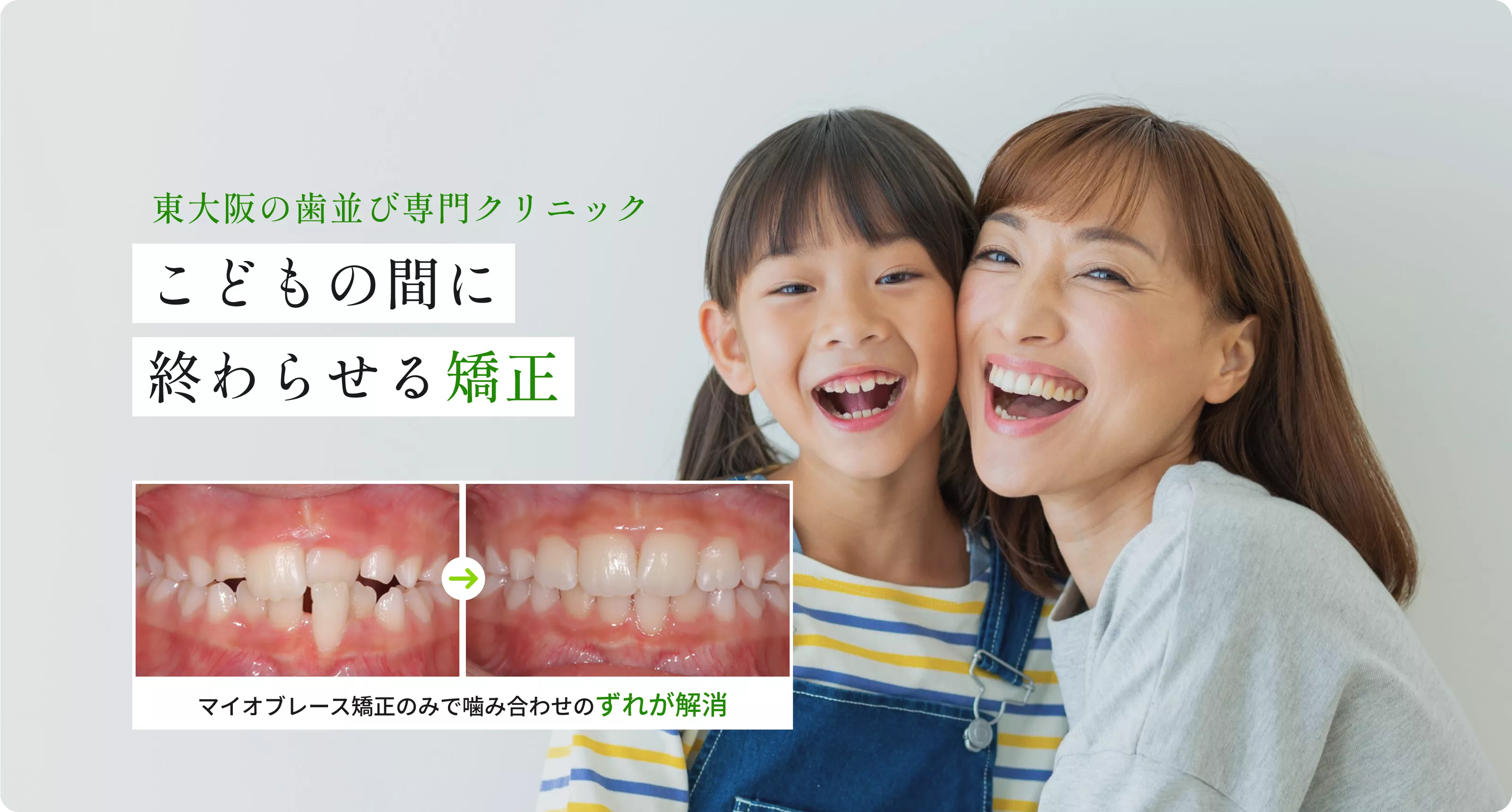 東大阪の歯並び専門クリニック こどもの間に終わらせる矯正